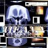 CT scan