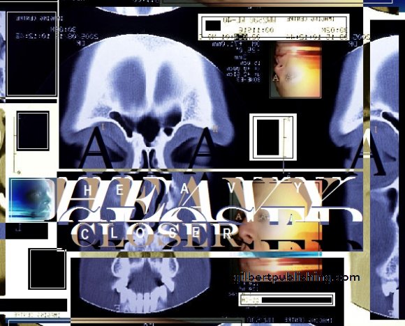 CT scan